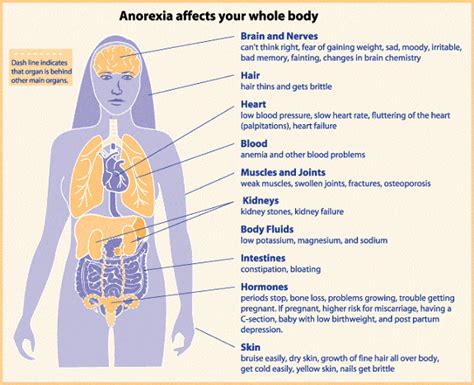 Physical signs and effects of anorexia nervosa Download Scientific