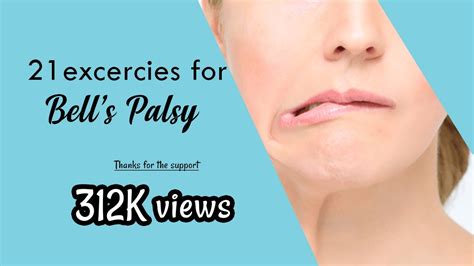 physical therapy for bell's palsy