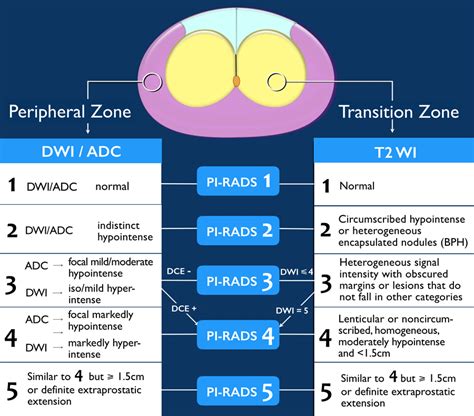 pi rads 2 lesion