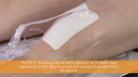 picco dressing in wound