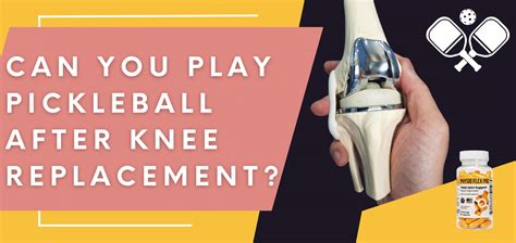 Pickleball Knee Replacement