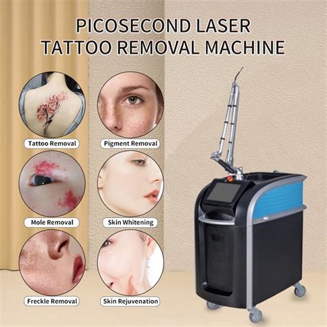 picosecond laser tattoo removal