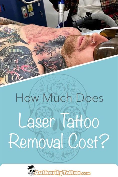 picosecond laser tattoo removal cost