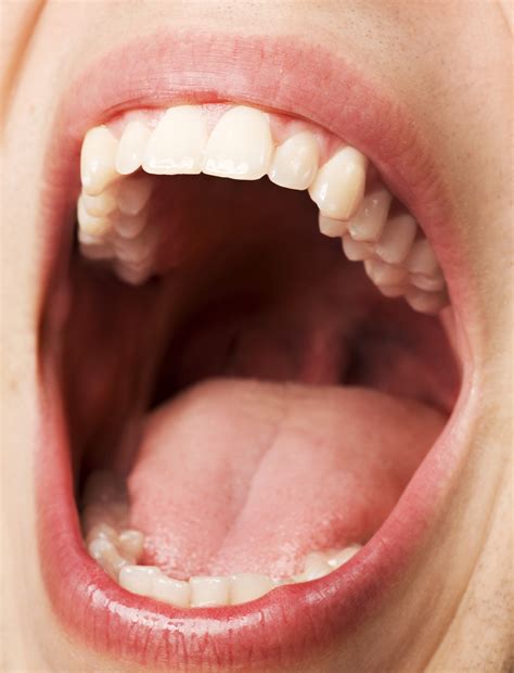 picture of an open mouth