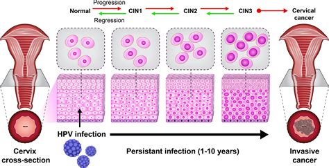 picture of hpv infection