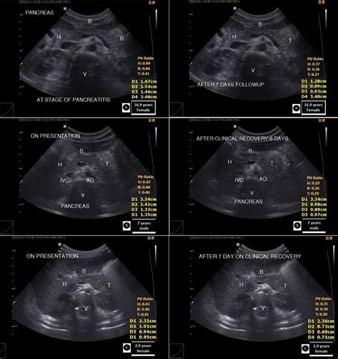 Pictures Of Sonograms