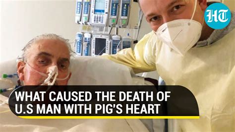 Pig Heart Guy Dies