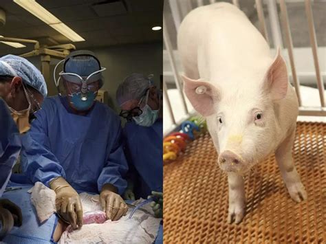 pig kidney transplant 2023