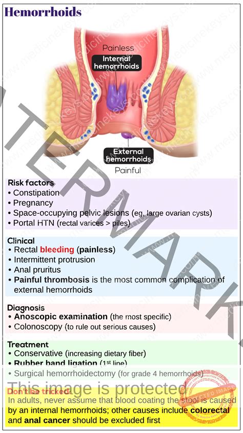 Piles Pic Unveiling: Discover Hidden Truths Behind Them