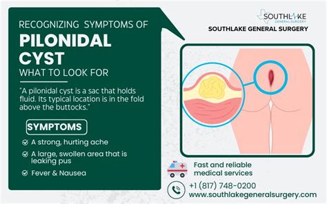 Pilonidal Cyst Symptoms
