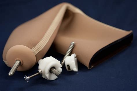 Pin Lock System Prosthesis