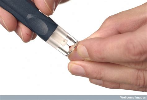 Pin Prick Definition