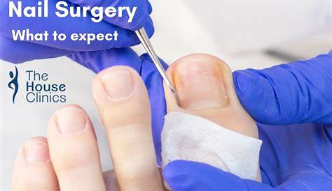 Pincer Nail Surgery Cost LNKOO Toenail Clippers, Clippers For Thick Toenail