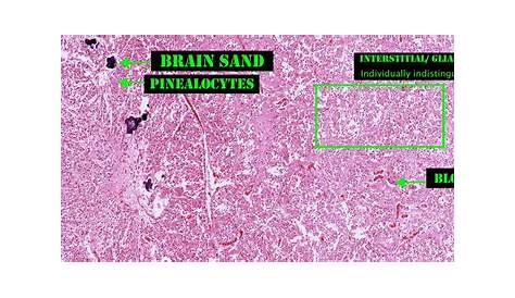 Pineal Gland Histology Labeled