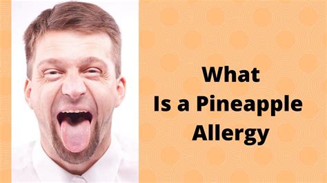 Pineapple Allergy Eyes