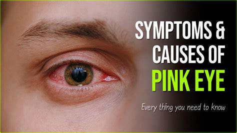 pink eye symptoms