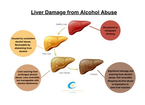 Liver Damage