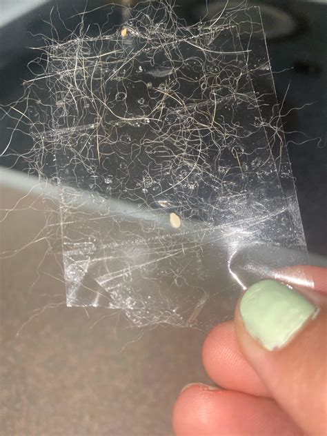 Uncovering the Truth: How Pinworm Eggs on Tape Can Reveal a Hidden Infection