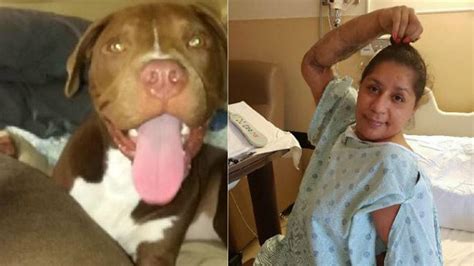 pit bull dog attacks the woman repeatedly