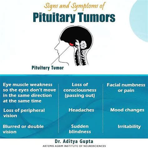 pituitary adenoma symptoms nhs
