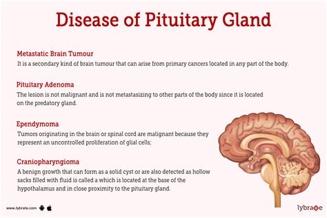 pituitary gland disorders