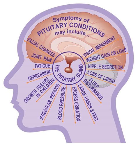 pituitary tumor symptoms in women