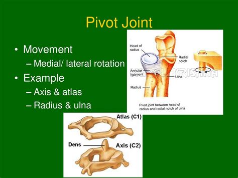 Pivot Joint Movement Example