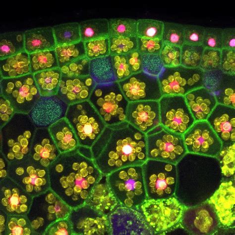 Microscope Plant Cell Chloroplast Micropedia