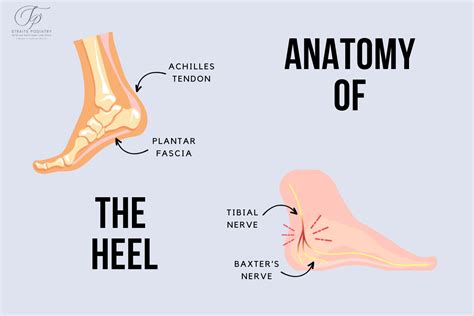 Plantar Heels