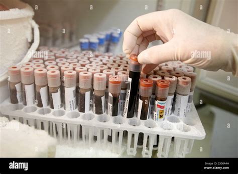 Plasma Sample Storage