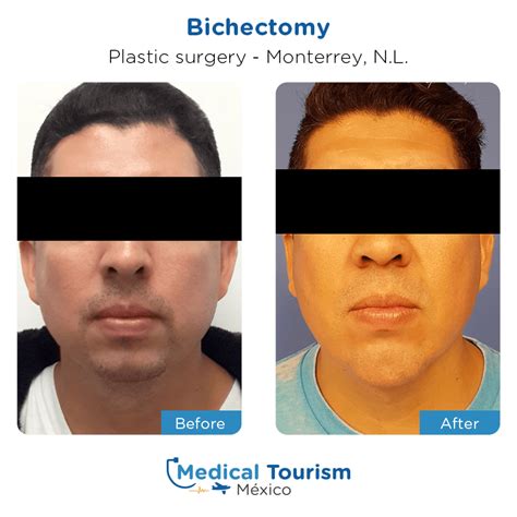 plastic surgeons in monterrey mexico