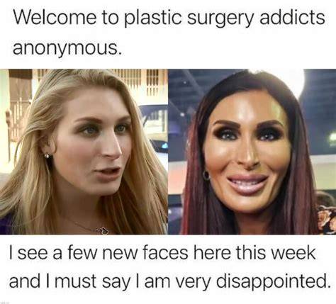Pin by Designer Katrina Griffin on Laughs for Me Kylie jenner plastic