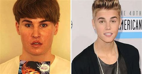 plastic surgery to look like justin bieber
