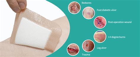 Plastic Wrap Dressing