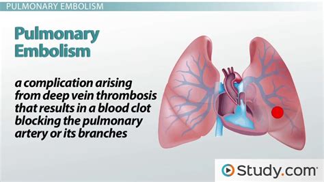 plural form of embolism
