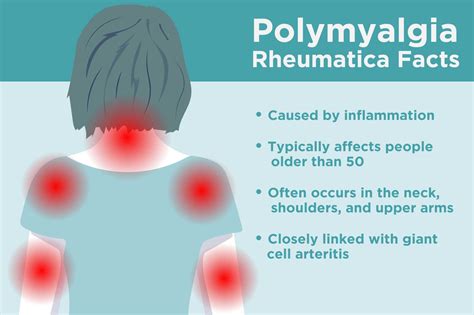 polyarthritis rheumatica symptoms