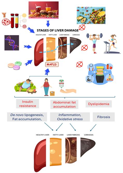 Polyphenols Liver Damage