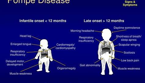 Pompe Disease Clinical Features GRAPHIC