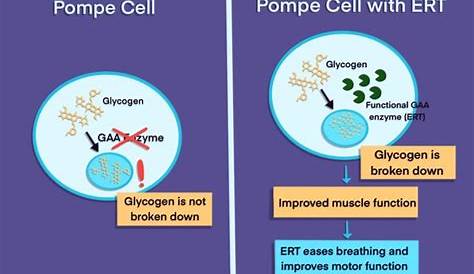 Pompe Disease Treatment Cost (PDF) effectiveness Analysis Of Enzyme Replacement