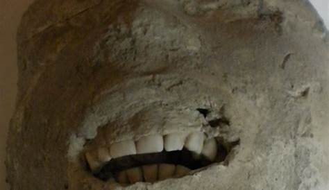 Pompeii Victims Had Perfect Teeth Because of Healthy Diet