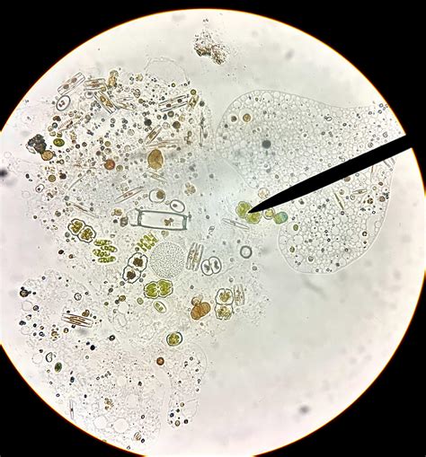 Pond Water Cell Under Microscope