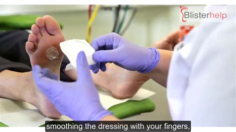 Should You Pop a Blister? Risks, Remedies, and When to Seek Medical Help