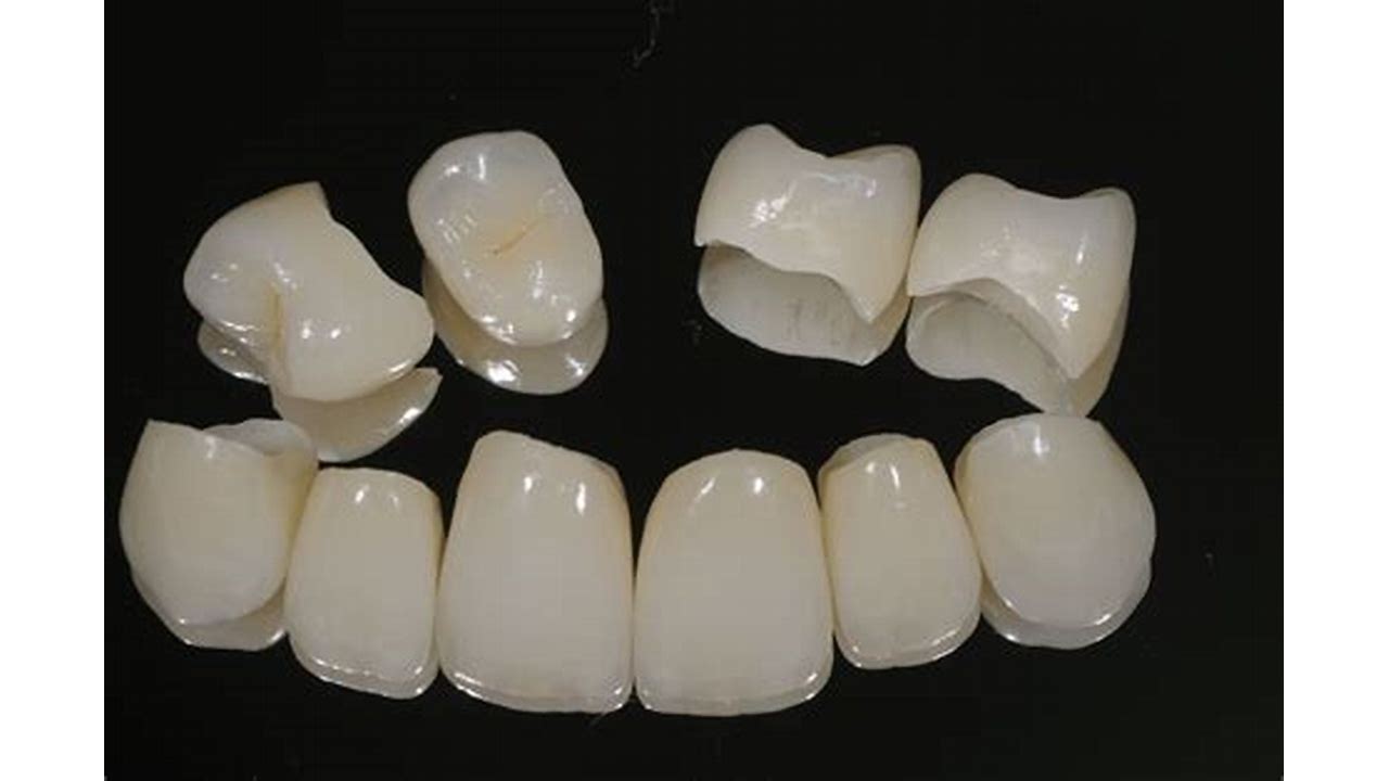 porcelain crown cost with insurance