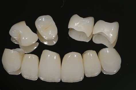 porcelain tooth crown
