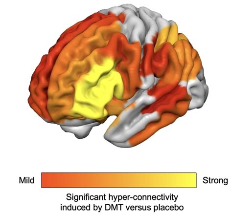 How Lsd Pushed My Sciatica Into Remission, And Why Dmt Might Do The Same