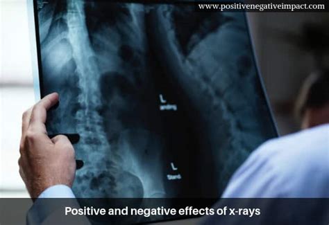 Top Positive Effects Of X Rays On Modern Medicine