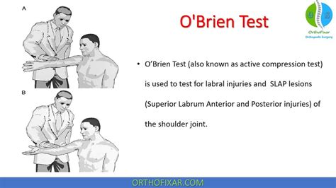 positive o'brien's test shoulder