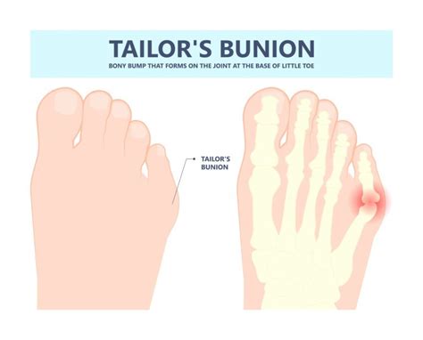 possible function of little toe