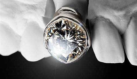 DOWNLOAD: Post Malone The Diamond Collection | Zip & Mp3 - UmLandi