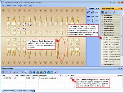 post and core code dentrix